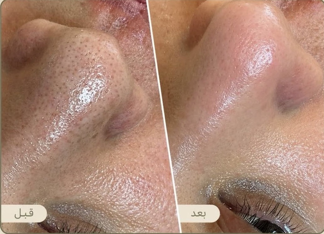 Behandlungsergebnis 2